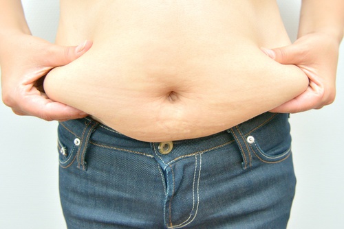 Excess Fat : Where is it Hiding? | US HCG Injections